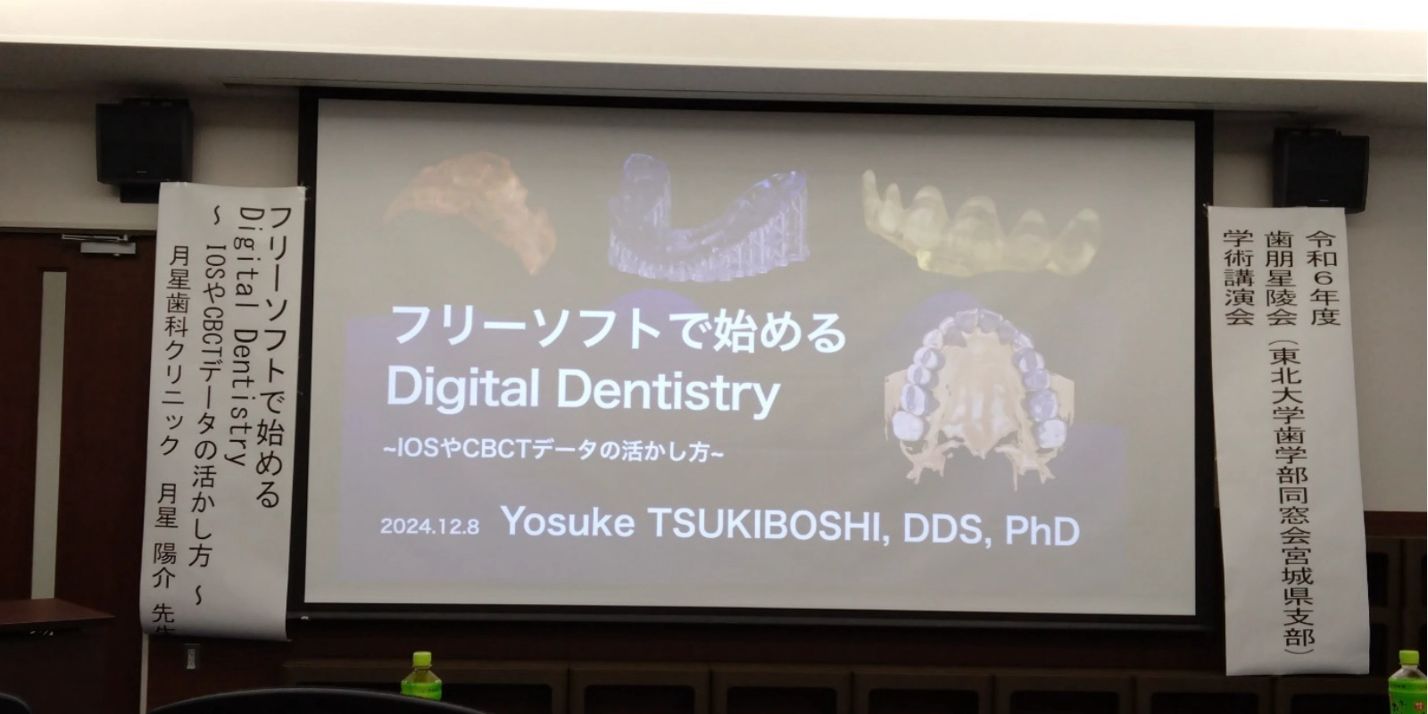 フリーソフトで始めるDigital Dentistry　‐IOSやCBCTデータの活かし方